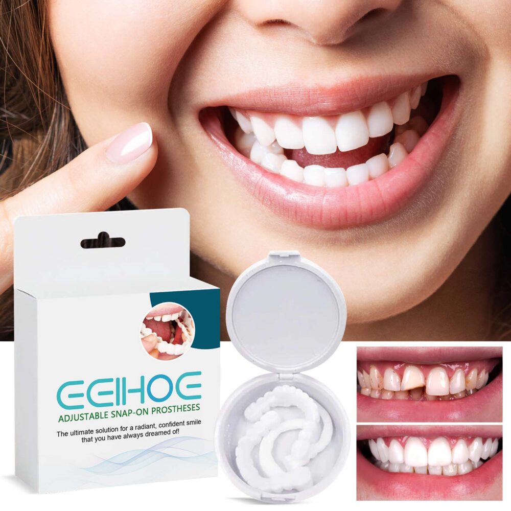 Removable Dental Veneers — Snap-On Smile